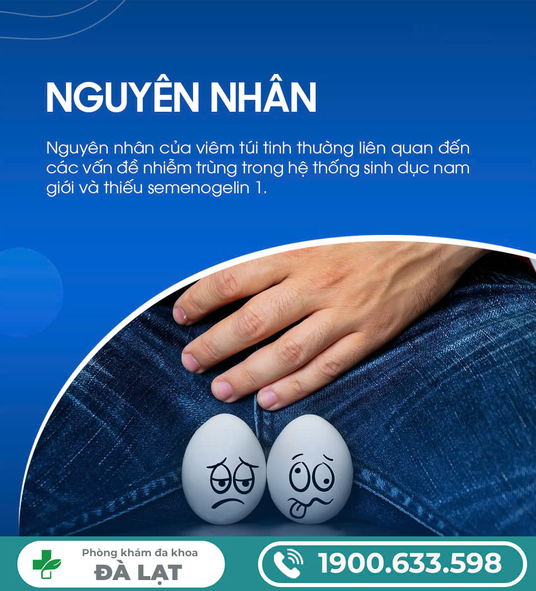 Hình ảnh minh họa
